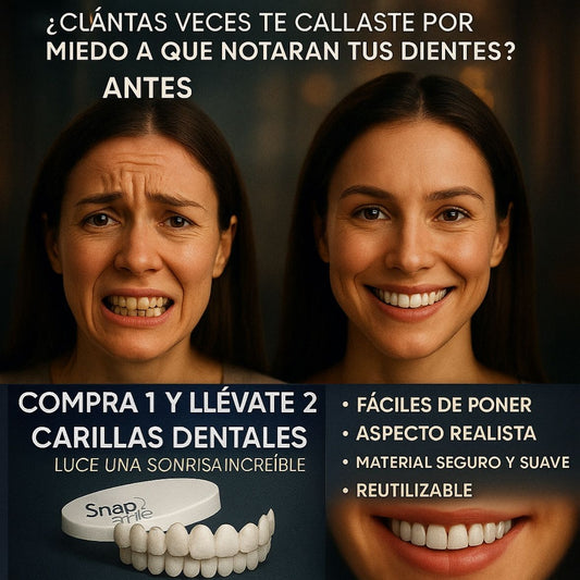 ¿TE DAN PENA TUS DIENTES? TRANSFORMA TU SONRISA AL INSTANTE - COMPRA 1 Y LLÉVATE 2 + REGALO SORPRESA - CARILLAS DENTALES FABRICADAS EN RESINA