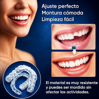 ¿TE DAN PENA TUS DIENTES? TRANSFORMA TU SONRISA AL INSTANTE - COMPRA 1 Y LLÉVATE 2 + REGALO SORPRESA - CARILLAS DENTALES FABRICADAS EN RESINA
