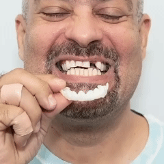 ¿TE DAN PENA TUS DIENTES? TRANSFORMA TU SONRISA AL INSTANTE - COMPRA 1 Y LLÉVATE 2 + REGALO SORPRESA - CARILLAS DENTALES FABRICADAS EN RESINA